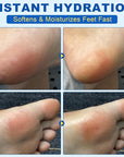Urea Cream Stick 60% plus Salicylic Acid 2%, Maximum Strength Urea Foot Cream for Dry Cracked Feet, Knees, Elbows, Hands, Exfoliating Dead Skin, Softening Skin Moisturizer (1PC, 40G)