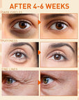 Under eye serum for puffiness: