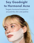 Rael Retinol Chin Mask with Miracle Clear Barrier Cream - Face Masks and Moisturizer, 2 Step Treatment, Niacinamide, Ceramide NP, for All Skin Types, Vegan, Korean Skincare (5 Kits)