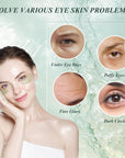 Under Eye Patches for Puffy Eyes and Dark Circles – 60 PCS Aloe Vera Under Eye Mask with Pure Natural Extracts to Combat Puffiness, Fine Lines, Wrinkles, and Bags
