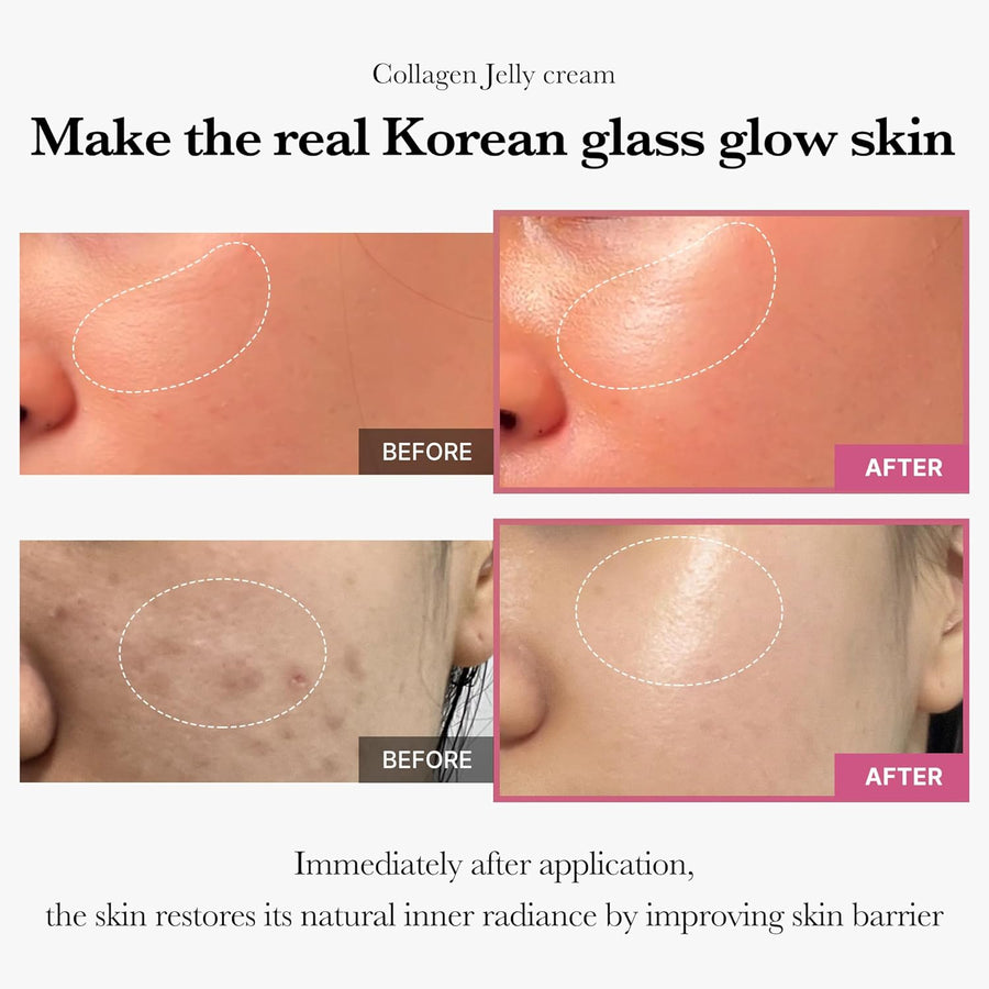 medicube Collagen Jelly Cream- Niacinamide & Freeze-Dried Hydrolyzed Collagen-Boosts skin barrier hydration & gives 24h Glow & Firmer looking skin | No artificial color, Korean skincare (3.71 fl.oz.)