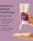 TriLASTIN-SR Intensive Stretch Mark Cream (5.5 Moisturizing