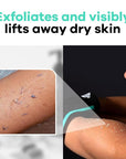 Dermasuri - Deep Exfoliating Glove - Korean Exfoliating Mitt - Reusable Body Scrubber for Shower - Buffs Dry Dead Skin - Keratosis Pilaris Treatment Scrub - Stocking Stuffer Gifts for Women & Men - XL