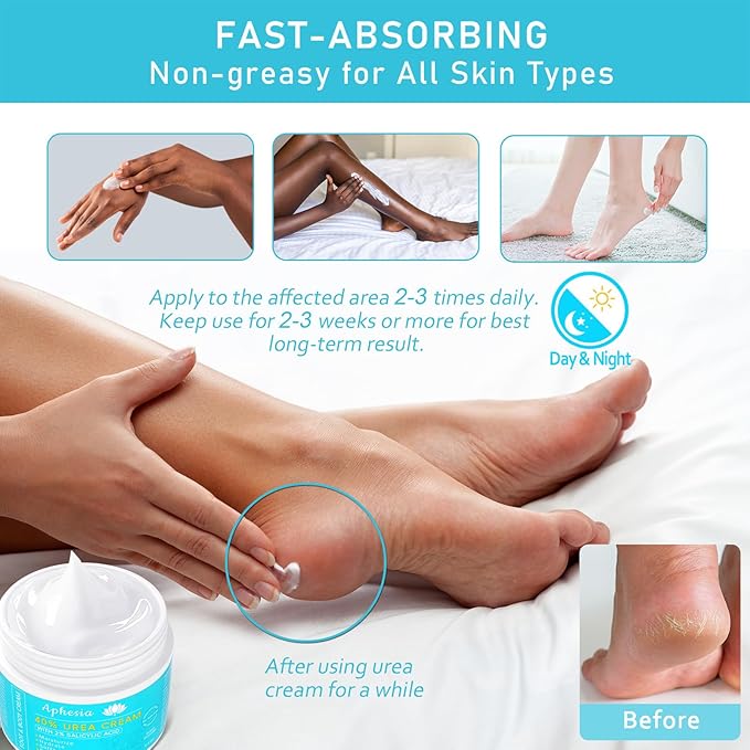 Urea Cream 40 Percent For Feet Maximum Strength - plus Salicylic Acid 2% Foot Cream For Dry Cracked Heels Feet Knees - Dead Skin Cuticle Callus Remover Toenail Softener