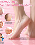 Heel Balm for Dry Cracked Feet (Peach), Urea Cream 60% Foot Balm Stick for Cracked Heel Repair - Moisturizes, Exfoliates, and Softens Dry, Thickened Skin, Callus Remover for Feet