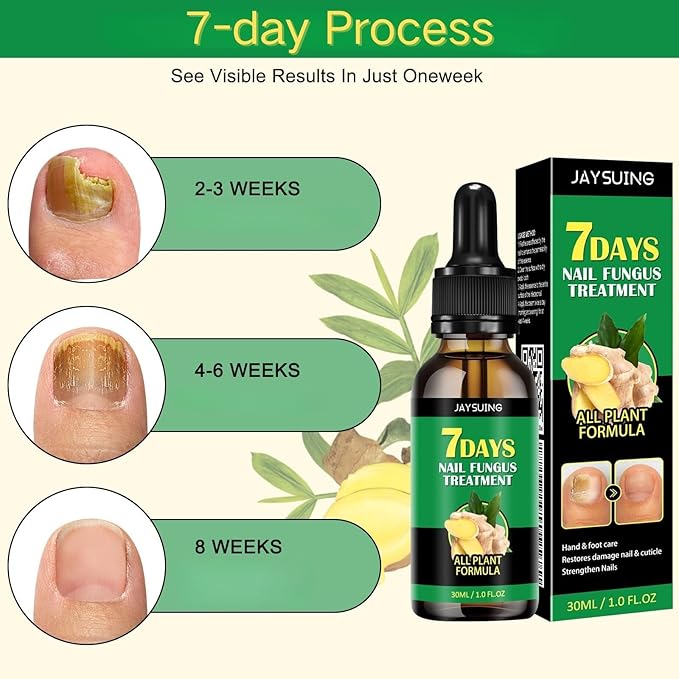 Ginger Nail Treatment, Nail Treatment,
