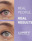 LUMIFY Eye Drops for Red Eyes, Redness Reliever for Brighter Looking Eyes, Works in 1 Minute & Lasts Up to 8 Hours, Eye Drops, 0.17 Fl Oz (5 mL)