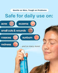 Hypochlorous Acid Spray – HOCl Face & Skin Mist for Acne, Eczema & Irritation – Multi-Purpose Skin Repair – Eyelid Cleanser, Post-Workout, Post-Procedure, Scalp & Sensitive Skin – 6.8 oz