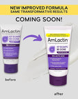 AmLactin KP Bumps Be Gone - 3 oz Keratosis Pilaris Moisturizing Cream with 15% Lactic Acid - Exfoliator and Moisturizer for Dry, Rough and Bumpy Skin (Packaging May Vary)