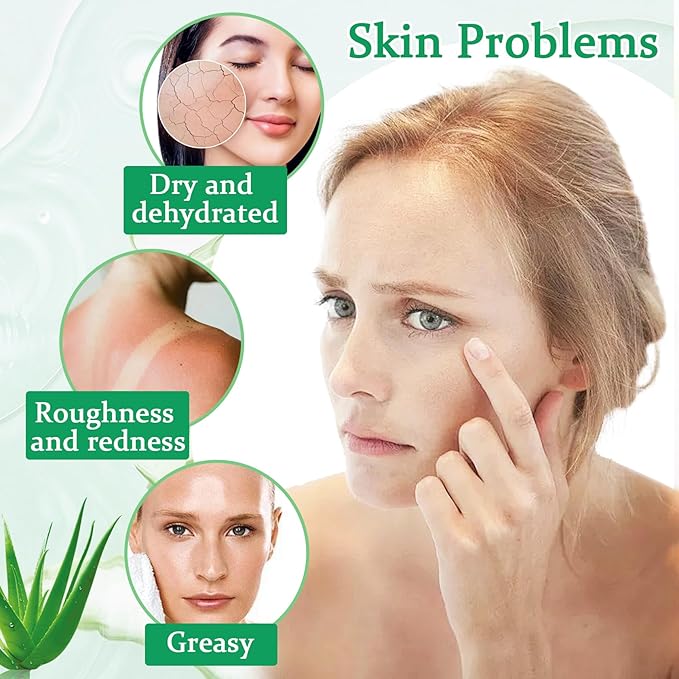 8PCS Aloe Vera Gel for Face & Skin,Organic Aloe Vera Gel,Hydrating After Sun Cream for Travel Size,Moisturizing Lotion for Skincare,After Sun Lotion for All Skin Type(A)