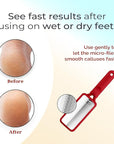 Microplane Colossal Foot File Scraper - The Original Stainless Steel Foot Rasp, Dead Skin/Callus Remover for Feet, Gentle Foot Scrubber, Pedicure Tools for Salon-Quality Foot Care, Red