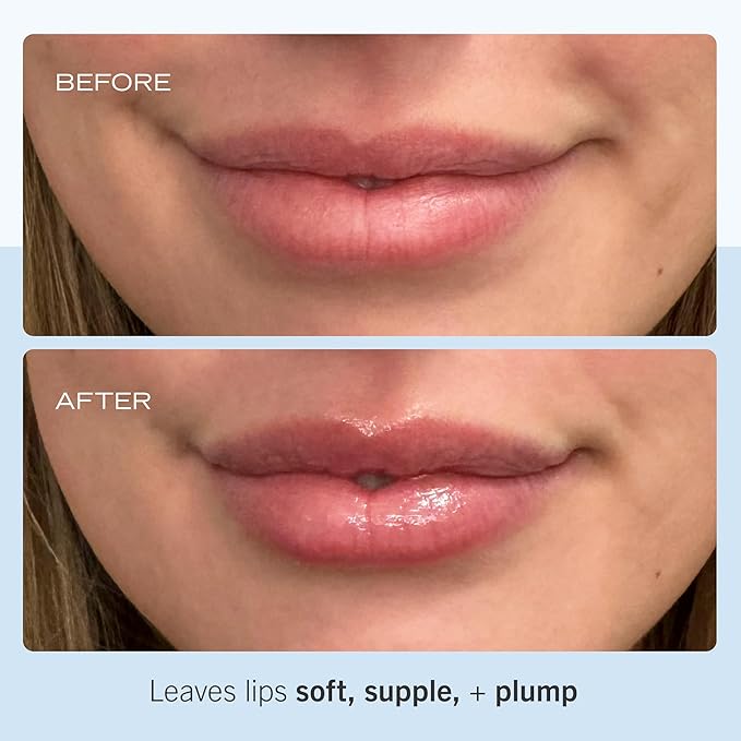 First Aid Beauty Ultra Repair Lip oz