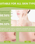 30pads turmeric kojic acid cleansing