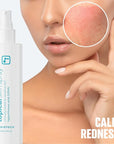 BRIOTECH Topical Skin Spray, Hypochlorous Acid Spray for Body & Face, Eyelid Cleanser, HOCl Facial Mist, Support Against Irritation, Calm Redness, Soothe Foot & Scalp, 128 fl oz (4 Pack)