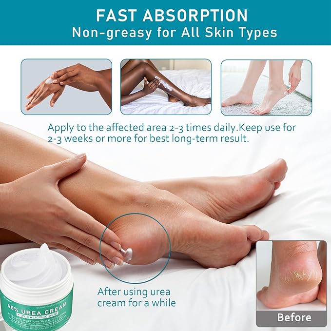 Urea Cream 40 Percent For Feet Maximum Strength - plus Salicylic Acid 2% Foot Cream For Dry Cracked Heels Feet Knees - Dead Skin Cuticle Callus Remover Toenail Softener - Pack of 2