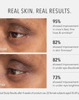 HydroPeptide Retinol Eye Renewal Lifting & Firming Eye Balm with 0.65% Universal Tri-Retinol Complex Peptide Solution, 0.5 Ounce