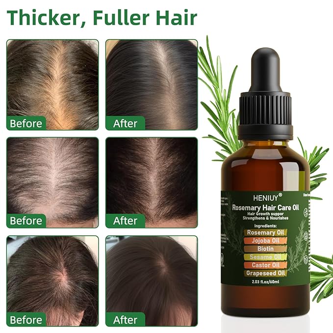 Pure Rosemary Oil Blended with Castor, Sesame, Jojoba and Grapeseed Oils to Promote Hair Growth, Biotin and Strengthen Hair, Dark Glass Bottle with Dropper 2Fl Oz