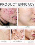 40pc turmeric kojic acid cleansing