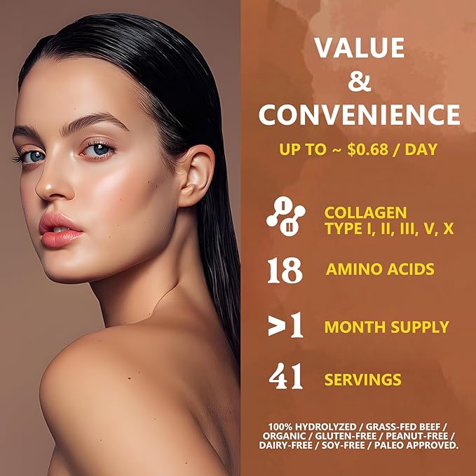 Zammex Multi Collagen Protein Powder, Type I & III & V & X, Hydrolyzed Collagen Peptides for Women & Men, Supports Hair and Skin, Gut Health, 41 Servings, Chocolate