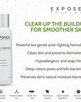 Exposed Skin Care Acne Facial Cleanser Clarifying