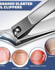 2025 Toenail Clippers for Thick Toenails for Seniors, Angled Head Large Toe Nail Clippers Set for Men, Heavy Duty Ingrown Toenail Clippers with Long Handle, Ultra Sharp Slanted Nail Cutter Wide Jaw