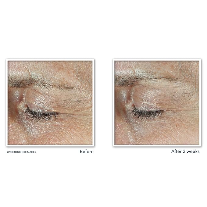 Roc derm correxion dual eye