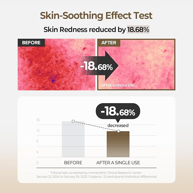 SKINFOOD Potato Madecassoside Soothing Toner Pad, Korean Skincare Facial Toner, Blemish Pads, Damaged Skin Barrier Improvement, Redness Relief, 8.81 oz (60 Pads)