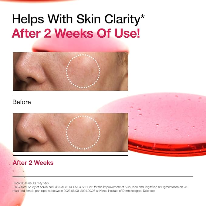 Anua Ultimate Spot Duo, Niacinamide 10 + TXA 4 Serum & Azelaic Acid 10 Hyaluron Redness Soothing Serum, Early & Post Spot Care, Skin Clarifying, Natural Color, Korean Skincare Set