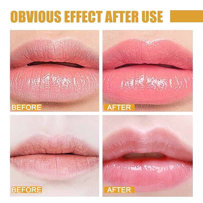2 Pcs Lip Balm Honey Pot, Lip.