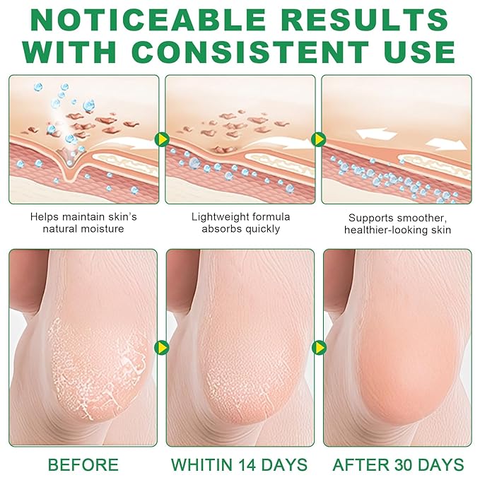 Heel Balm for Dry Cracked Feet (Aloe Vera), Urea Cream 60% Foot Balm Stick for Cracked Heel Repair - Moisturizes, Exfoliates, and Softens Dry, Thickened Skin, Callus Remover for Feet