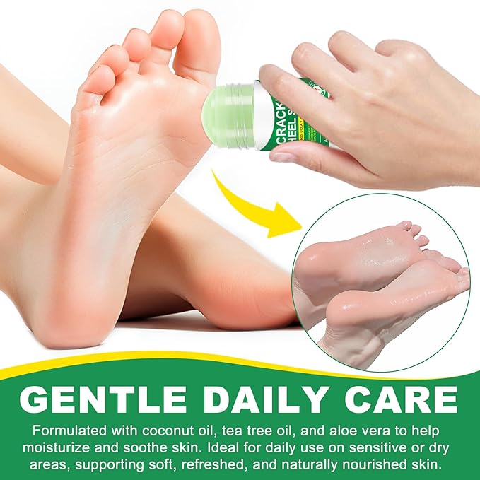 Heel Balm for Dry Cracked Feet (Aloe Vera), Urea Cream 60% Foot Balm Stick for Cracked Heel Repair - Moisturizes, Exfoliates, and Softens Dry, Thickened Skin, Callus Remover for Feet