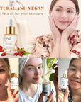 ANAI RUI Squalane + Vitamin E Rosehip Oil Moisturizer for Face Hydrate, Reduce Scars and Stretch Marks, Wrinkles for Smoother, Softer Skin 1 fl. Oz