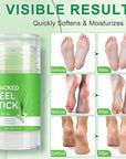 Urea Cream Stick 60% plus Salicylic Acid 2%, Maximum Strength Urea Foot Cream for Dry Cracked Feet, Knees, Elbows, Hands, Exfoliating Dead Skin, Softening Skin (1 PC Aloe Vera, 40G)