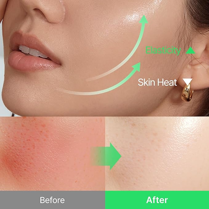 shaishaishai ALOE PDRN Cooling Repair Ampoule, 10% Vegan Collagen, 10 Types Hyaluronic Acid, Cooling Hydration & Soothing, Glow Serum, Korean Skincare, 1.69 Fl Oz
