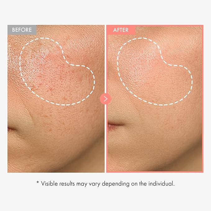 TOSOWOONG Peach 80 Niacin Serum, 5% Niacinamide, Alpha-Arbutin, Vitamin B12, Glass Skin, Hydrating Face Serum for Dark Spots, Pore Minimizer, Uneven Tone, Dullness, Korean Skincare, 33ml/1.11 fl. oz.