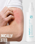 BRIOTECH Topical Skin Spray, Hypochlorous Acid Spray for Sensitive Skin, HOCl Facial Mist, Full Body Support Against Irritation, Calm Redness, Soothe Foot & Scalp, 8 oz (1 Pack)