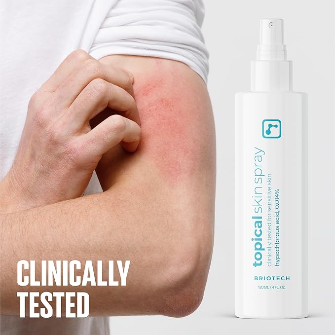 BRIOTECH Topical Skin Spray, Hypochlorous Acid Spray for Sensitive Skin, HOCl Facial Mist, Full Body Support Against Irritation, Calm Redness, Soothe Foot & Scalp, Travel Size 2 oz