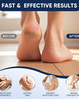Urea Cream 40 Percent for Feet Maximum Strength, Urea Cream 40% Plus Salicylic Acid 2%, Foot & Hand Cream for Dry Cracked