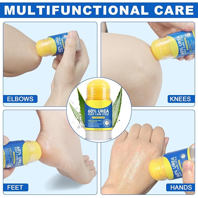 60% Urea with 2% Salicylic Acid Urea Foot Care Stick, Foot Cream Moisturizer for Dry Cracked Feet, Knees, Elbows, Hands, Moisturizes and Hydrates, Callus Remover & Skin Softener 1.41oz (2PC, 40G)