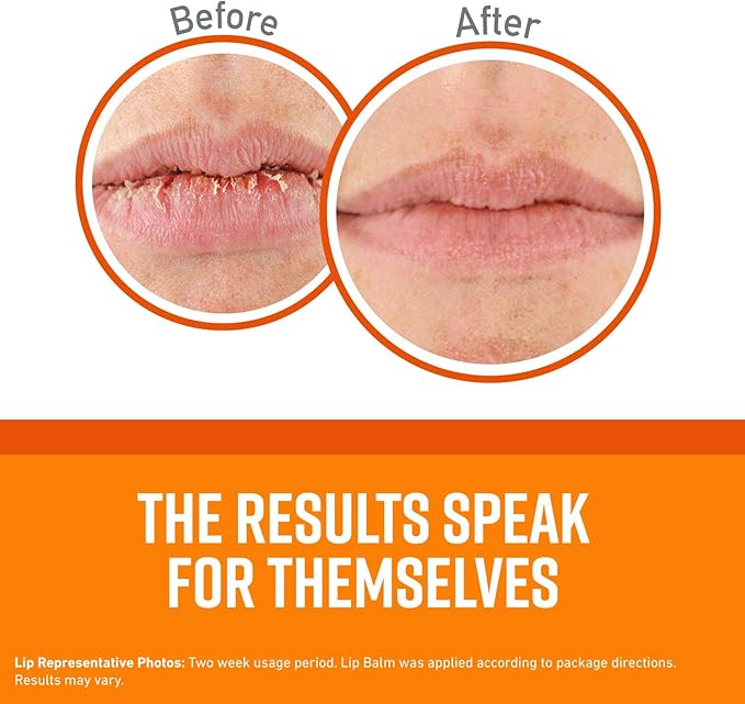 O'Keeffe's Lip Repair Lip Balm Cooling