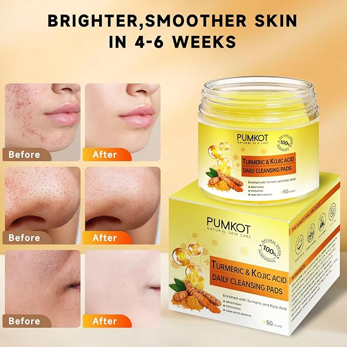 Turmeric Kojic Acid Cleansing Pads, Turmeric Face Scrub Pads Enriched with Kojic Acid, 50PCS