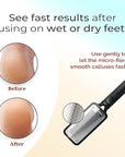 Microplane Colossal Foot File Scraper - The Original Stainless Steel Foot Rasp, Dead Skin/Callus Remover for Feet, Gentle Foot Scrubber, Pedicure Tools for Salon-Quality Foot Care, Black