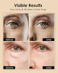 Instant firm eye cream: temporary