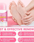 Heel Balm for Dry Cracked Feet (Peach), Urea Cream 60% Foot Balm Stick for Cracked Heel Repair - Moisturizes, Exfoliates, and Softens Dry, Thickened Skin, Callus Remover for Feet