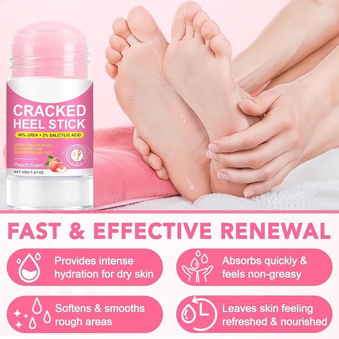 Heel Balm for Dry Cracked Feet (Peach), Urea Cream 60% Foot Balm Stick for Cracked Heel Repair - Moisturizes, Exfoliates, and Softens Dry, Thickened Skin, Callus Remover for Feet