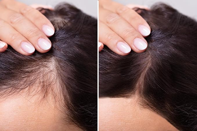 velona Hair Growth Formula - 4 oz | Castor, Amla, Jojoba, Argan, Rosemary, Peppermint, Tea Tree Oils, Vitamin E | Natural Mix with Organic Carrier and Essential Oils