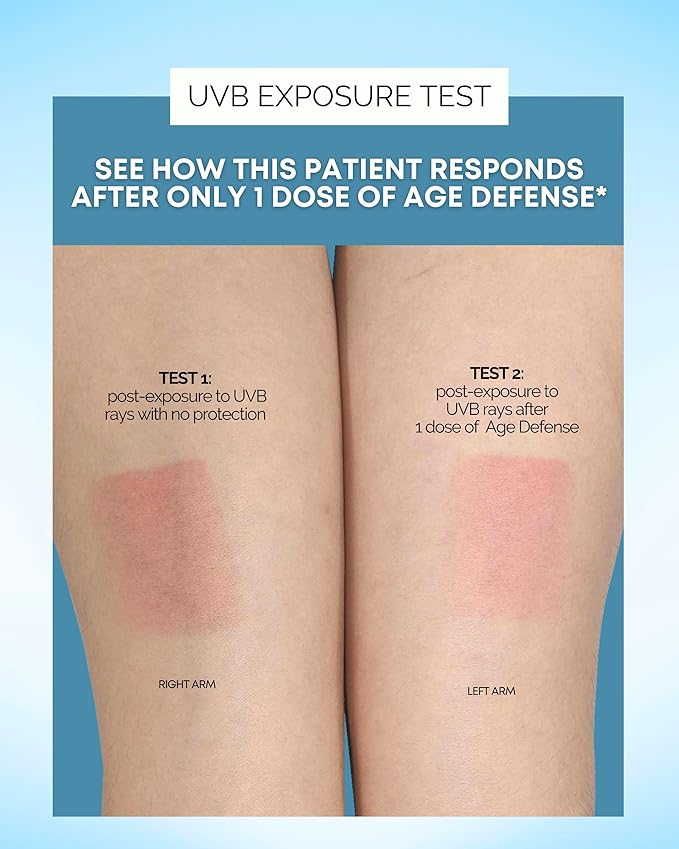 Age Defense Vitamins - Dermatologist and Plastic Surgeon Developed to Fight photoaging and Melasma, Polypodium Leucotomos Antioxidant Formula – Vegan, Gluten-Free – 60 Capsules