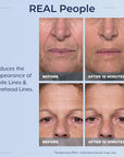 Plexaderm Rapid Reduction Eye Serum - Visibly Reduces Under-Eye Bags, Wrinkles, Dark Circles, Fine Lines & Crow's Feet Instantly, Anti Aging Wrinkle Remover for Face, 30 Single Use Pods
