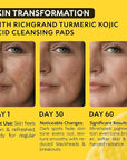 Turmeric Kojic Acid Cleansing Pads - Exfoliating Turmeric Pads for Face Dark Spots, Discoloration - Daily Skin Care for Men & Women - Natural Glow Facial Wash