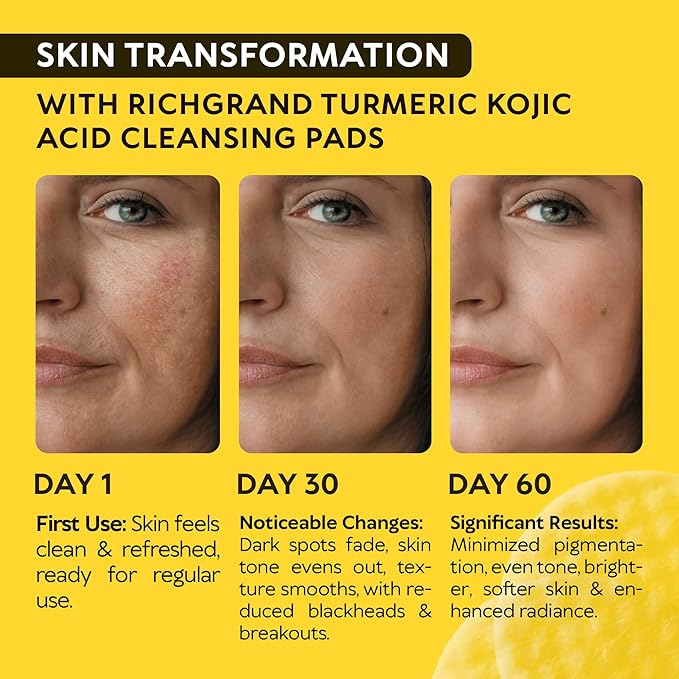 Turmeric Kojic Acid Cleansing Pads - Exfoliating Turmeric Pads for Face Dark Spots, Discoloration - Daily Skin Care for Men & Women - Natural Glow Facial Wash